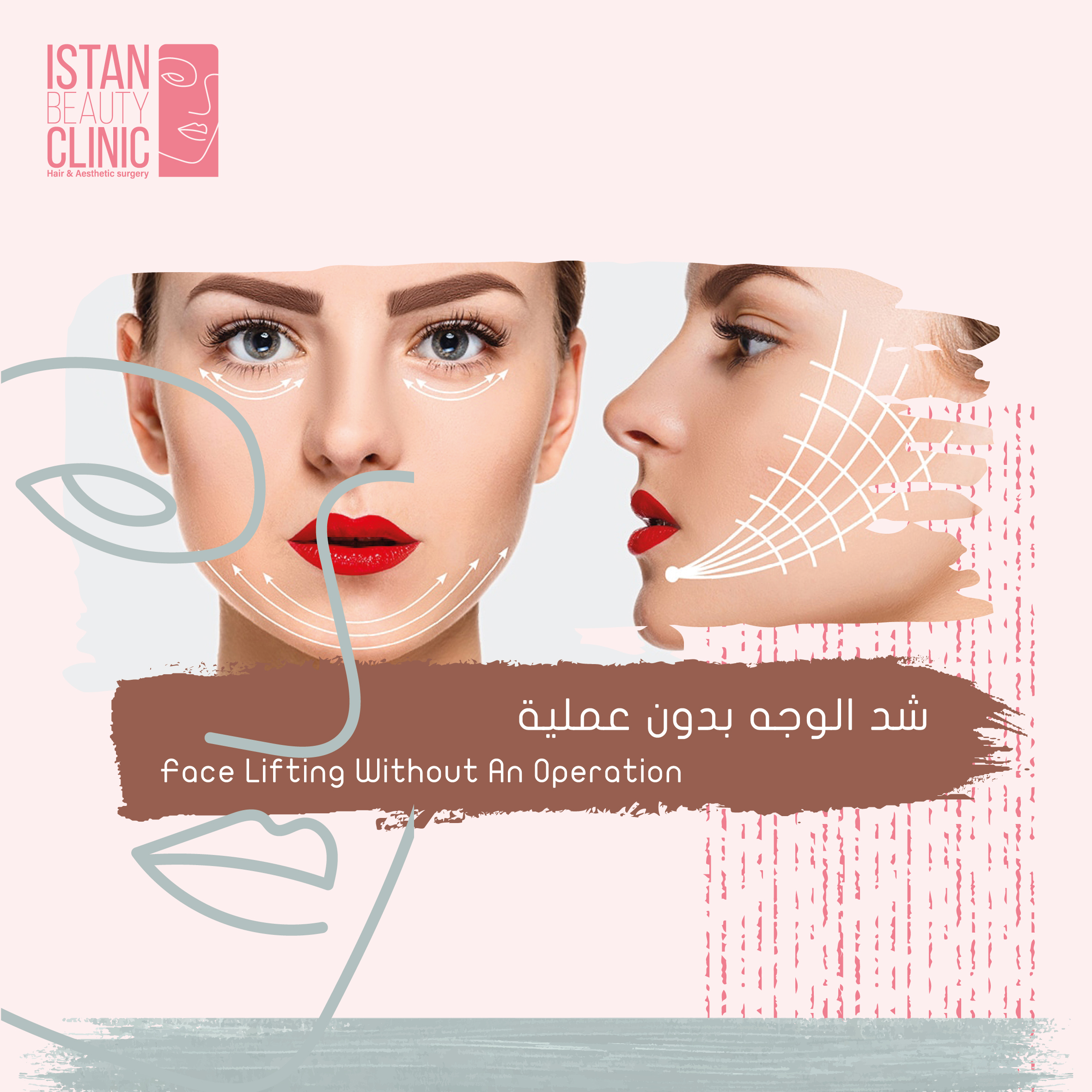 Face Lifting Without an Operation