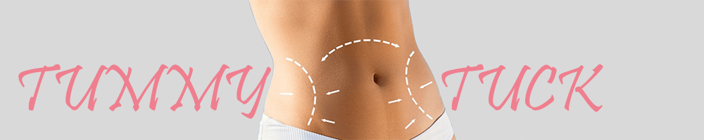 Tummy Tuck