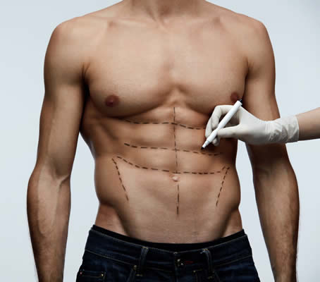 Ventricular Muscle Aesthetics